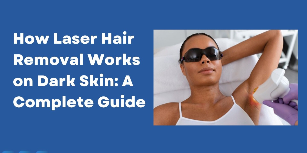 How Laser Hair Removal Works on Dark Skin: A Complete Guide